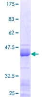 Human HMGIY / HMGA1 Protein (Recombinant GST, N-terminus)