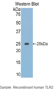 TLR2 Antibody (aa644-784)