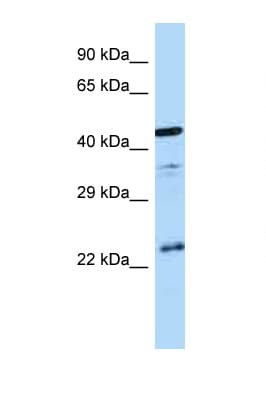 Polyclonal Rabbit anti-Human AVPR1B Antibody (C-Terminus, WB)