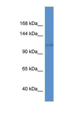 KCNH8 / ELK Antibody (aa960-1009)