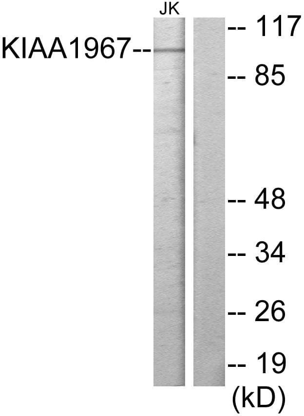 CCAR2 / KIAA1967 Antibody