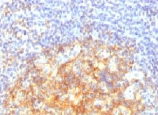 VCAM1 / CD106 Antibody (clone CDLA106, Ready-to-Use)