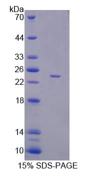 Mouse PEBP1 / RKIP Protein (Recombinant His)
