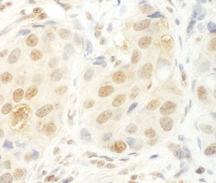 UTP6 Antibody (aa565-597)