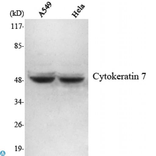 KRT7 / CK7 / Cytokeratin 7 Antibody