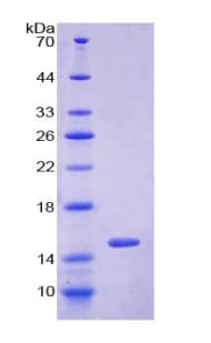 Human GLRX / Glutaredoxin Protein (Recombinant His-T7)