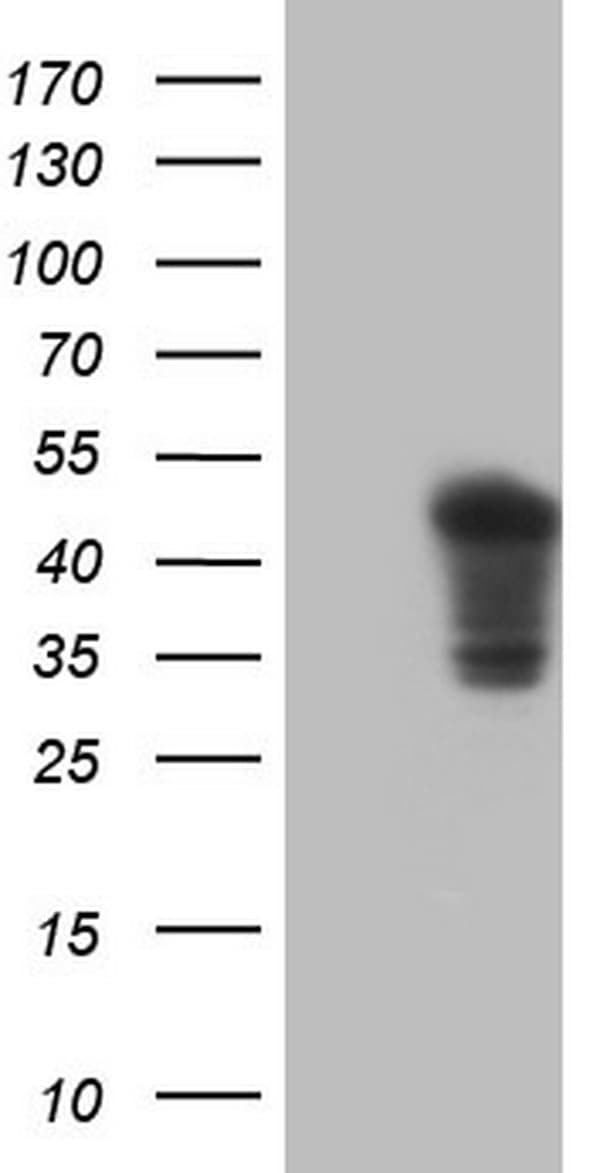 TNNT2 / CTNT Antibody (clone OTI1G9)