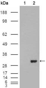 CA1 / Carbonic Anhydrase I Antibody (Amino Acid: 25-90, clone 9D6D7)