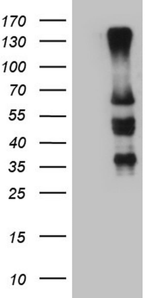 Monoclonal Mouse anti-Human IKZF3 / AIOLOS Antibody (clone OTI4H7, aa1-301, IHC, WB)