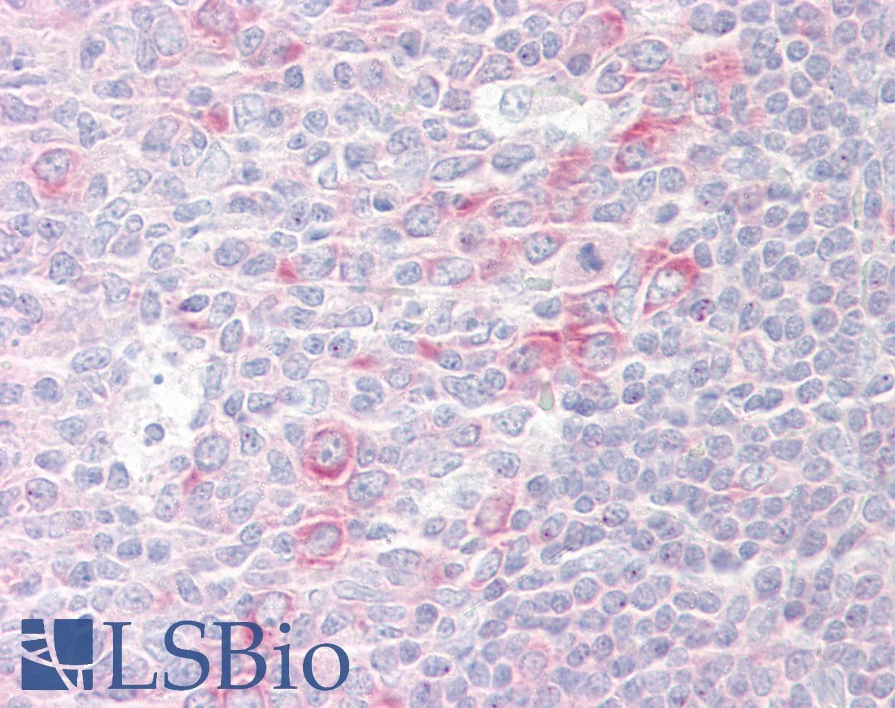 IHC-plus™ RPL17 / Ribosomal Protein L17 Antibody (aa101-150)