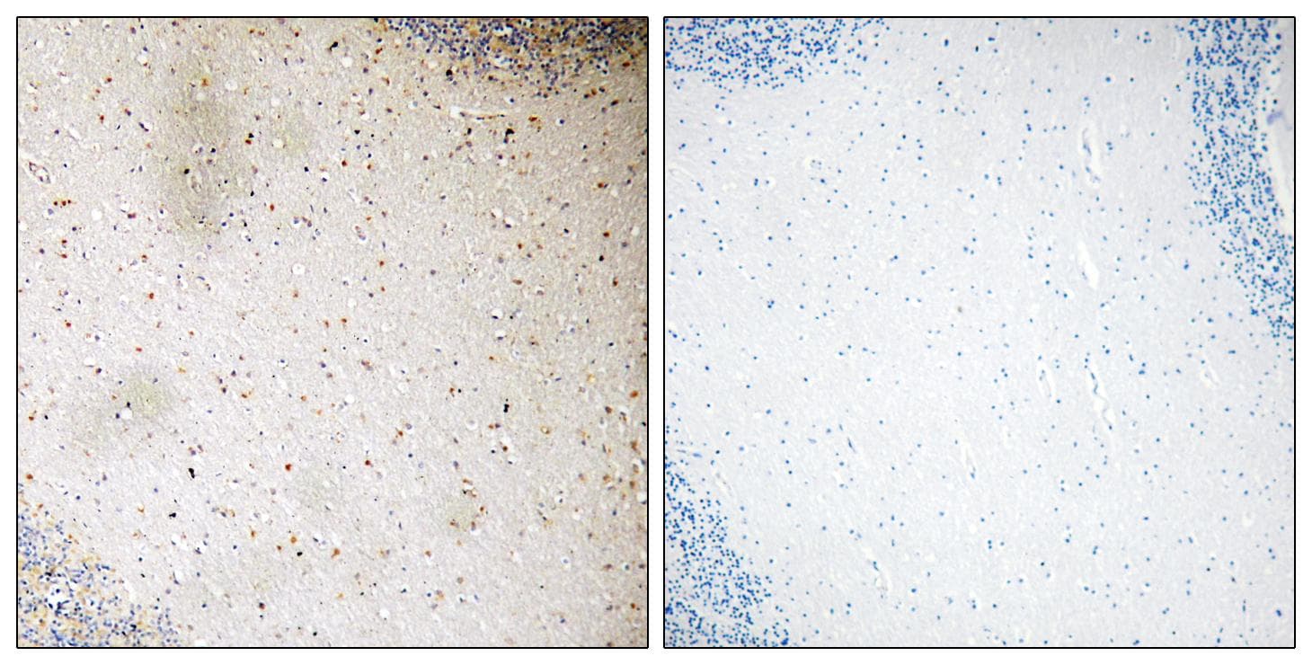 DOK2 Antibody (p345)