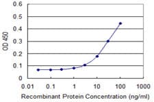 RCN1 / Reticulocalbin 1 Antibody (clone 1F8-E4)