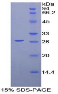 Mouse PRNP / PrP / Prion Protein (Recombinant His, N-Terminal)