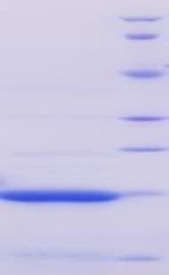 Mouse ACPP / PAP Protein (Recombinant His)
