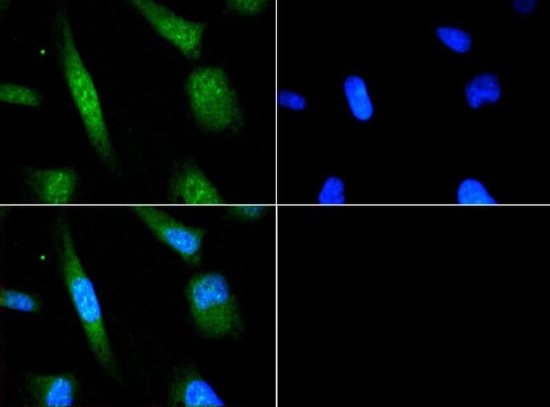 ATF6 Antibody
