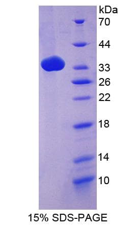 Mouse Complement C4 Protein (Recombinant 6His, N-terminus)