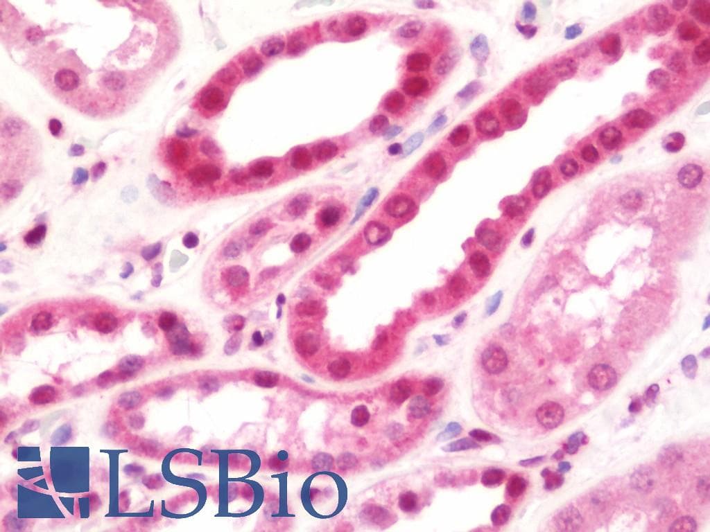 IHC-plus™ Polyclonal Rabbit anti-Human NUDR / DEAF1 Antibody (Internal, IHC, WB)
