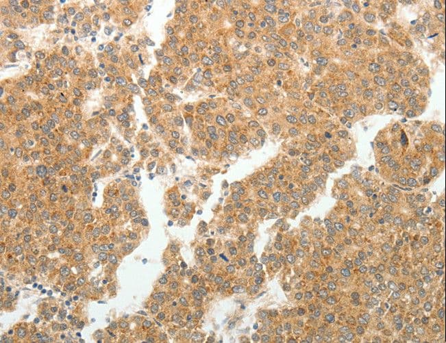 Polyclonal Rabbit anti-Human SIP1 Antibody (IHC)