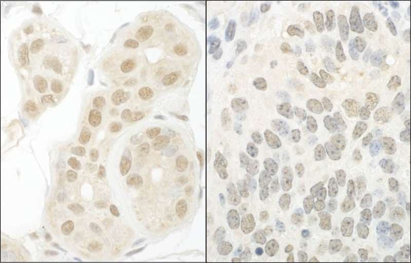 Polyclonal Rabbit anti-Human GTF2A1 / TFIIA Antibody (aa100-150, IHC)