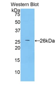TLR5 Antibody (aa693-858, APC)