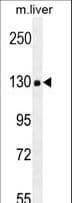 Endostatin Antibody (aa1311-1339)