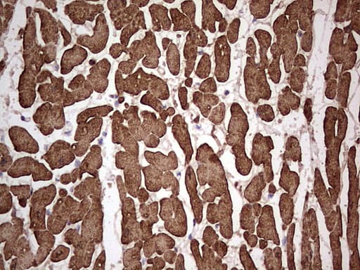 Monoclonal Mouse anti-Human TNNC1 / Cardiac Troponin C Antibody (clone OTI5H3, IHC)