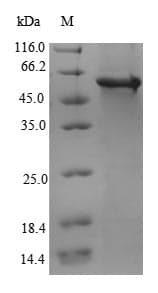 Human L2HGDH Protein (Recombinant 6His-SUMO, N-terminus)