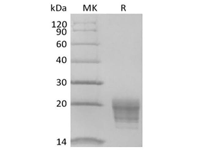 Human IL5 Protein (Recombinant AVI-6His, C-terminus)