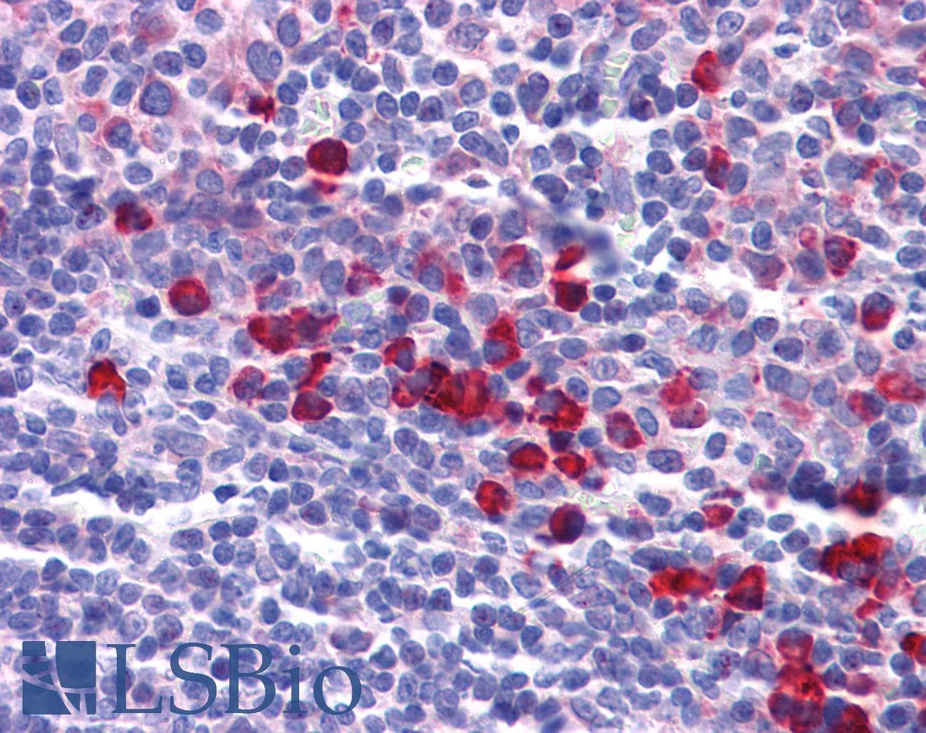 IHC-plus™ Polyclonal Rabbit anti-Human KITLG / SCF Antibody (IHC, IF, WB)