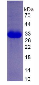 Human EIF2AK2 / PKR Protein (Recombinant His, N-Terminal)