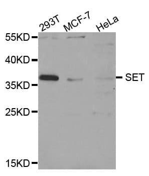 Polyclonal Rabbit anti-Human SET / TAF-I Antibody (IHC, WB)