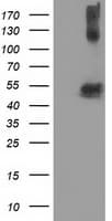 Monoclonal Mouse anti-Human TUBB4 / Tubulin Beta 4 Antibody (clone OTI5C1, IHC, IF, WB)