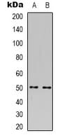 PSPLA1 / Phospholipase A1 Antibody (C-Terminus)