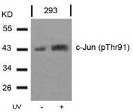 Polyclonal Rabbit anti-Human JUN / c-Jun Antibody (IHC, WB)