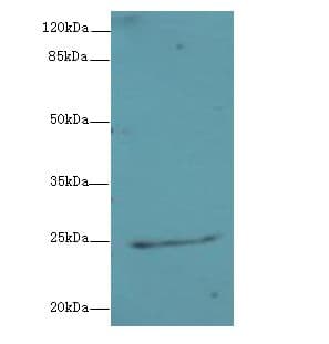 NEGR1 / Neurotractin Antibody
