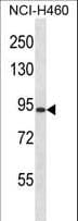 RGS9 Antibody (aa149-178)