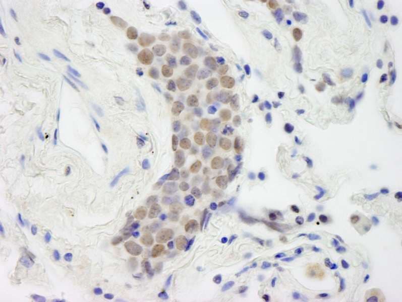 TOP2B / Topoisomerase II Beta Antibody (aa1570-C-term)