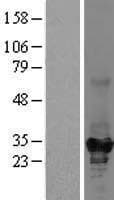 KHK / Ketohexokinase Protein (Over-Expression Lysate Myc-DDK (Flag))