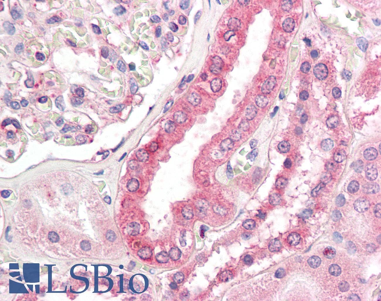 IHC-plus™ Polyclonal Rabbit anti-Human FACL2 / ACSL1 Antibody (IHC, IF, WB)