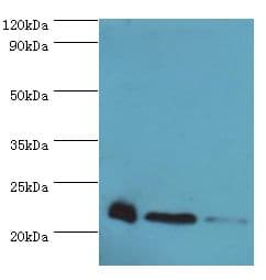 PRDX5 / Peroxiredoxin 5 Antibody (aa53-214)