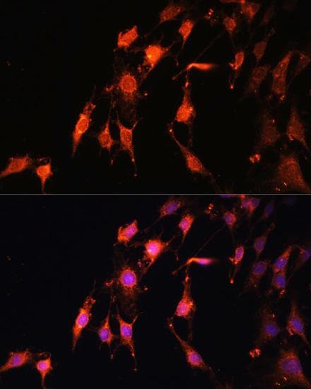 Polyclonal Rabbit anti-Human PRR5 Antibody (IF)