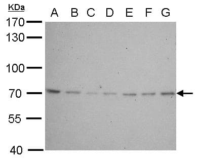 LMNB2 / Lamin B2 Antibody (aa221-500)