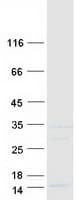 Human SS18L2 Protein (Recombinant Myc-DDK (Flag))