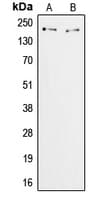 ZNF106 / ZFP106 Antibody (C-Terminus)