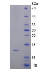 Mouse ANXA4 / Annexin IV Protein (Recombinant His)