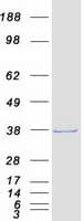 Human CMT2 / MAD2L1BP Protein (Recombinant Myc-DDK (Flag))