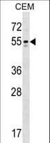 KCNA6 / Kv1.6 Antibody (aa1-30)