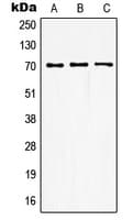 Polyclonal Rabbit anti-Human GUCY1B3 Antibody (N-Terminus, IHC, WB)