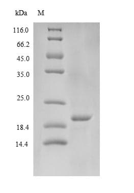 Mouse JCHAIN / Ig J Chain Protein (Recombinant 6His-SUMO, N-terminus)
