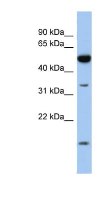 RDH12 / LCA3 Antibody (aa215-264)